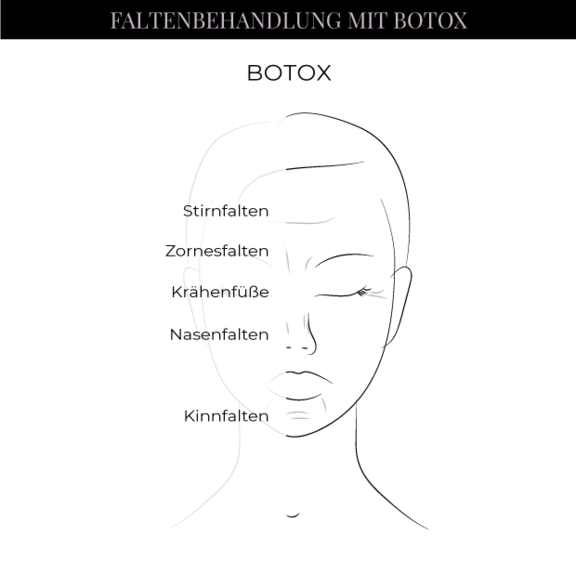 Grafik BTX, Schönheitschirurgie in Hamburg, Dr. med. Alaleh Jamshidi